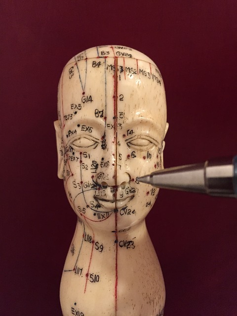 Leczenie migreny akupunkturą na Śląsku i w Białymstoku