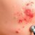 Jak działa dermatolog: choroby skóry, diagnostyka i leczenie